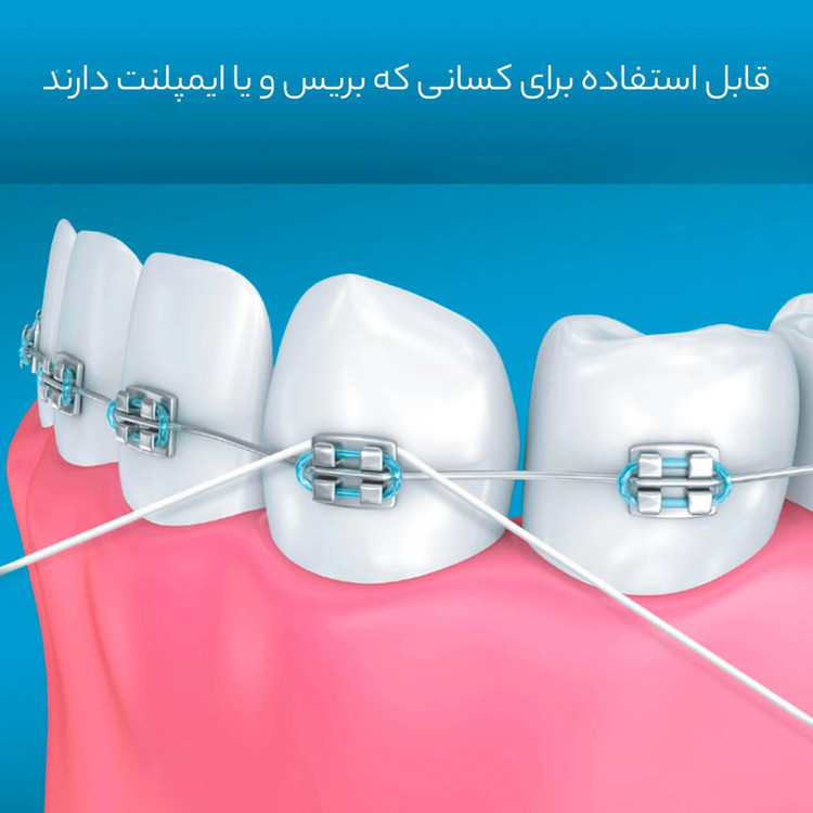 نخ دندان اورال-بی مدل superfloss