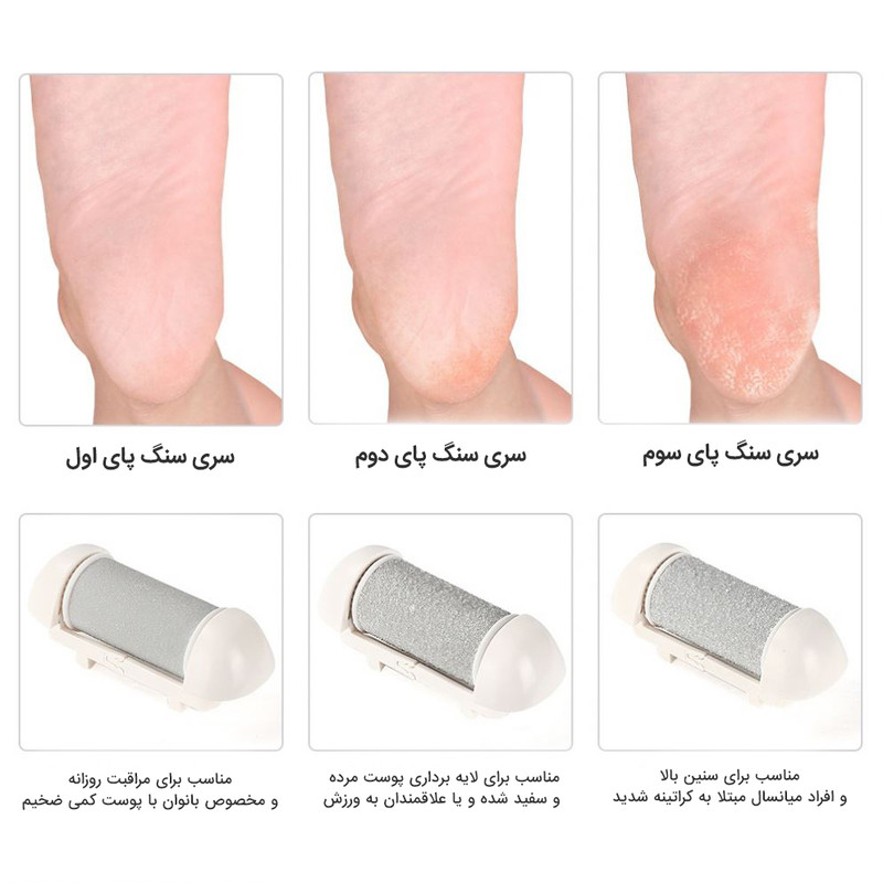 سنگ پا برقی گلویش استایل مدل ZCA001